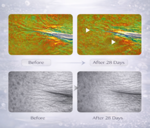 Before and after skin imaging after 28 days showing reduced wrinkle depth and smoother skin texture.